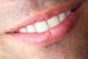 Zdravé a bílé zuby jsou symbolem zdraví a úspěchu. Dental care.